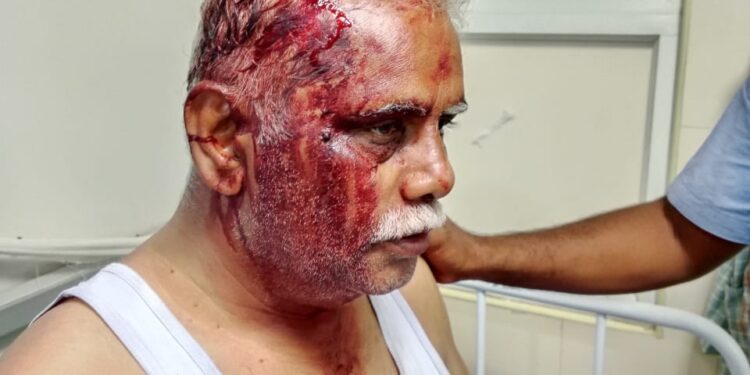 பெட்ரோல் பங்க் மேலாளருக்கு அரிவாள் வெட்டு