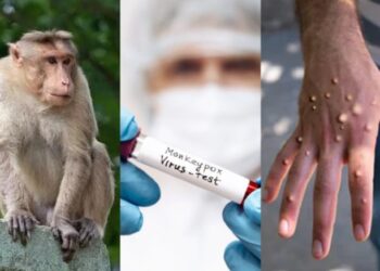 வேகமாக பரவும் குரங்கு அம்மை: நீலகிரி மாவட்டத்தில் முன்னெச்சரிக்கை நடவடிக்கை!