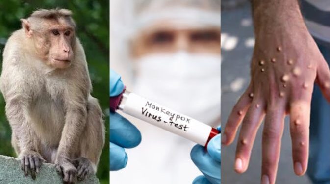 வேகமாக பரவும் குரங்கு அம்மை: நீலகிரி மாவட்டத்தில் முன்னெச்சரிக்கை நடவடிக்கை!